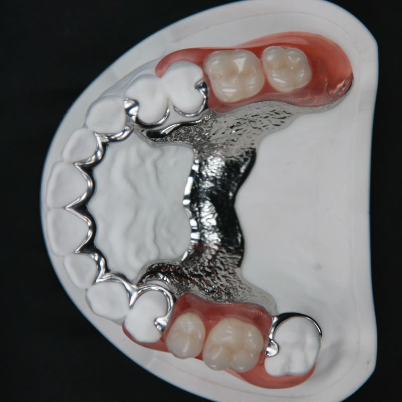 Prótesis dental confeccionada a medida